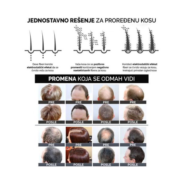 DERMA HAIR Fiber za kosu 22gr Crni - MedSan562