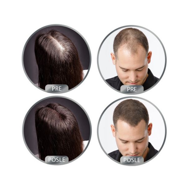 DERMA HAIR Fiber za kosu 22gr Crni - MedSan562