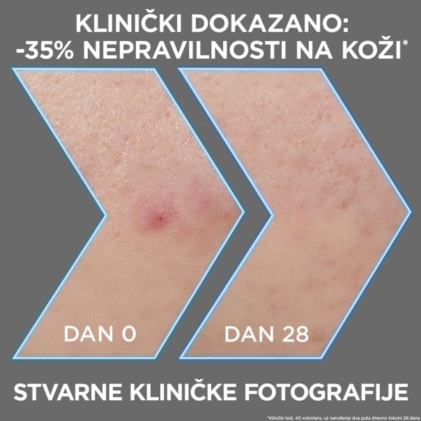 GARNIER Pure Active Crni serum Anti-imperfection, 30 ml - 1100013703