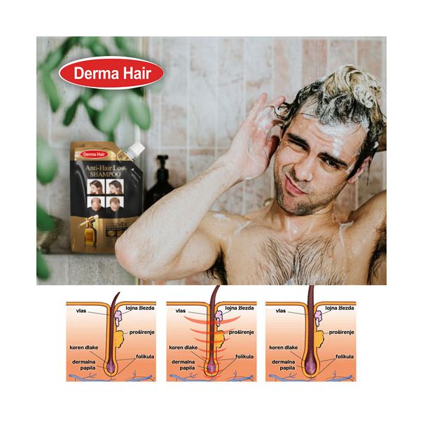 DERMA HAIR Šampon protiv gubitka kose 300ml - MedSan594