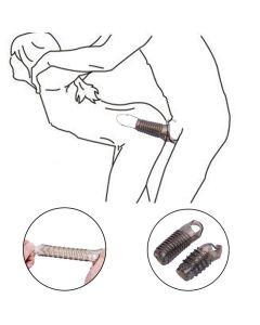 Silikonska navlaka za penis sa prstenom (odlaganje)
